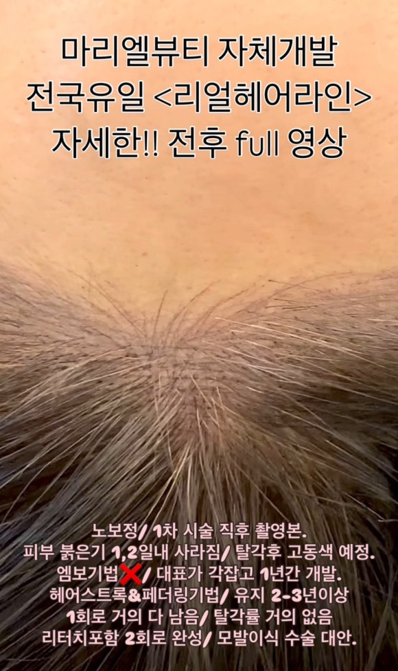 마리엘헤어 이미지