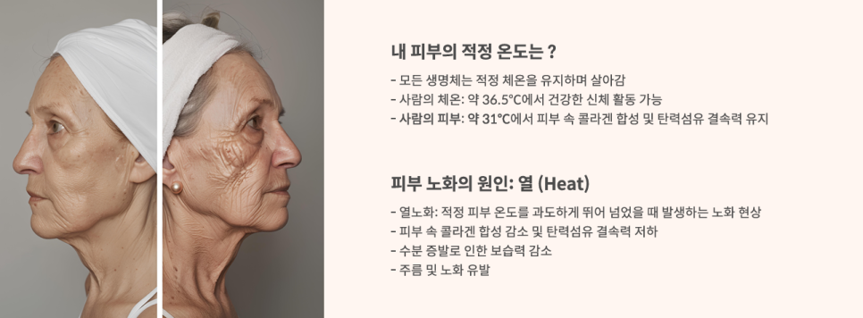 에프이티 이미지