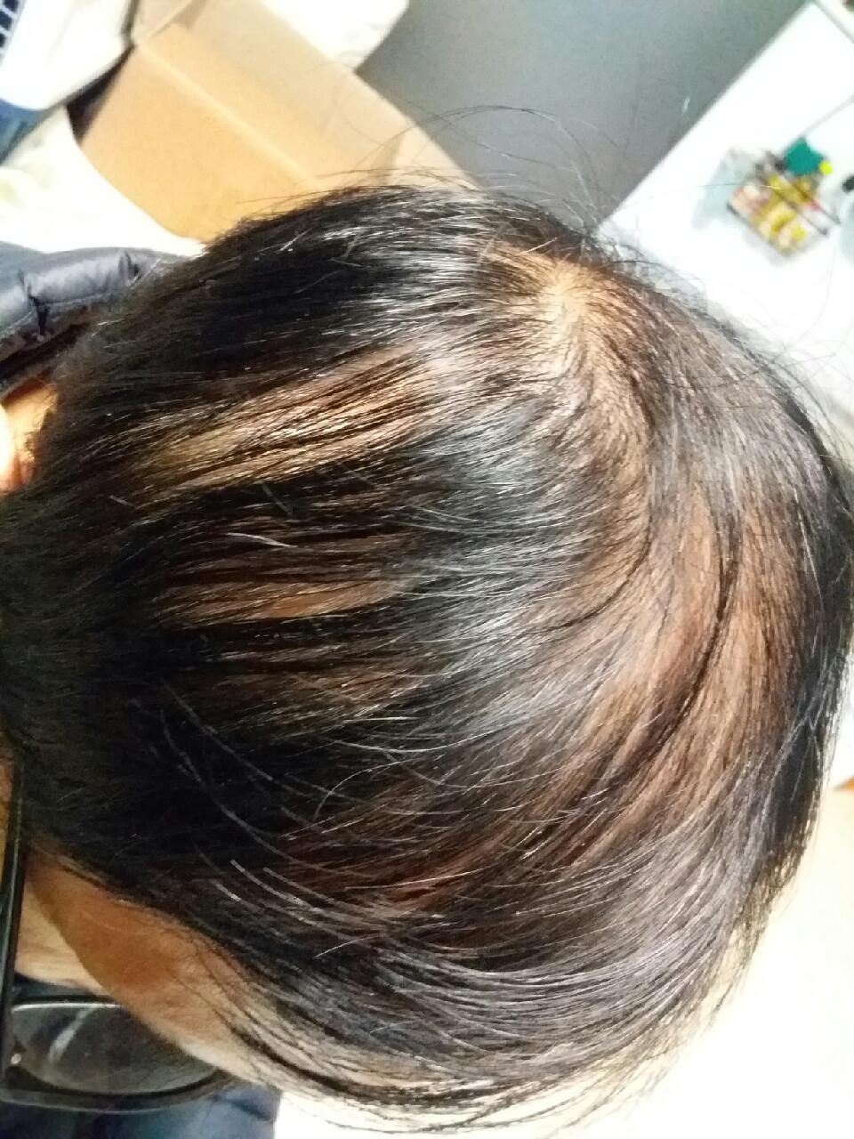머리나라 이미지