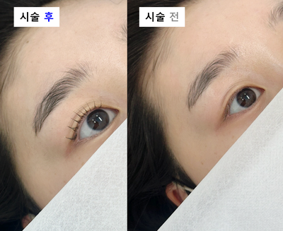 브로우윤결 이미지