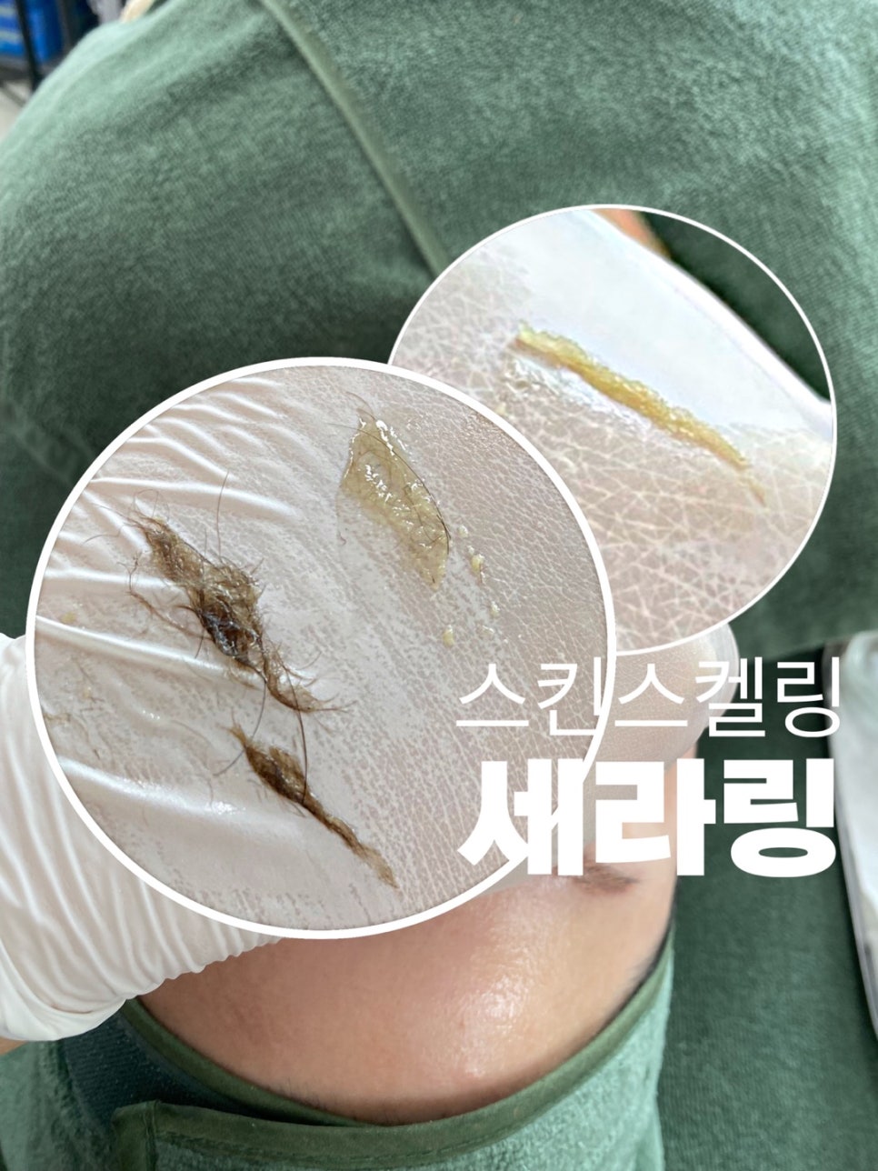 깨끄시 이미지