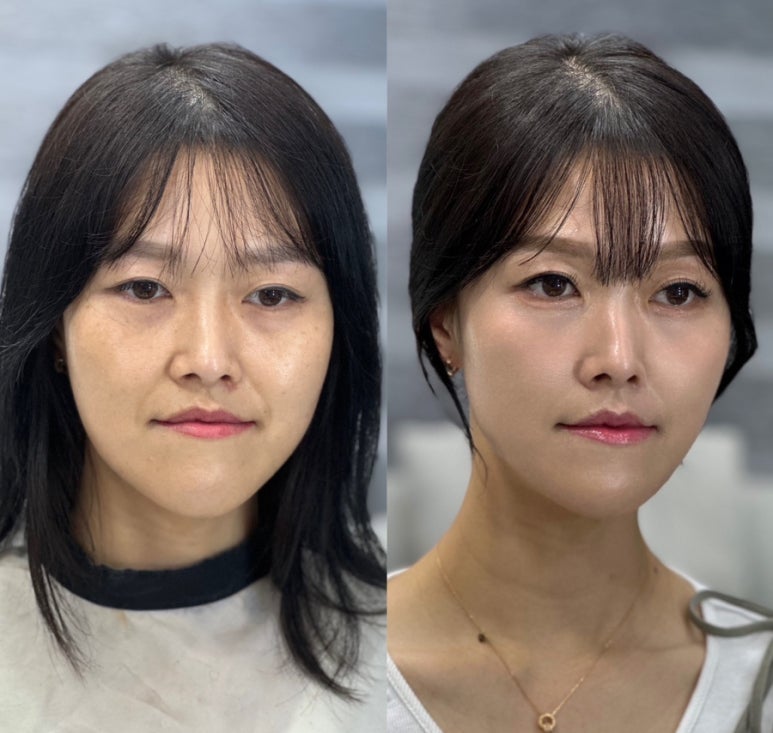 유라임 이미지