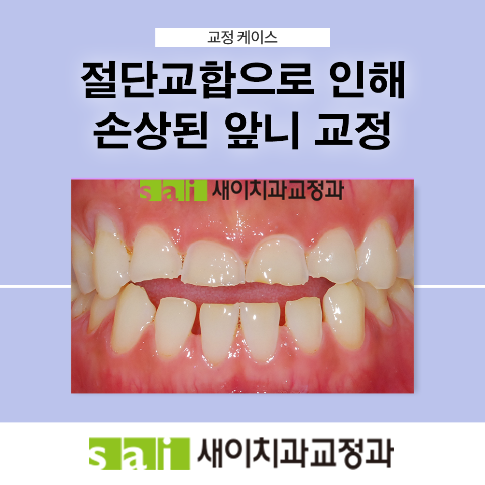새이치과교정과치과의원 이미지