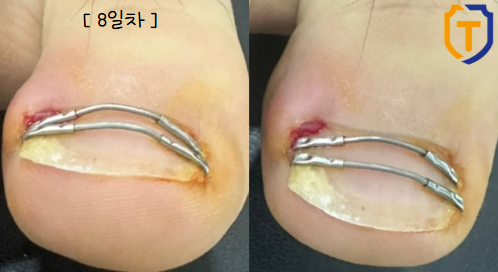 청담탑정형외과의원 이미지