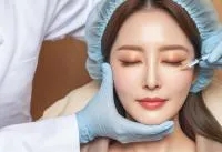 이나코 이미지