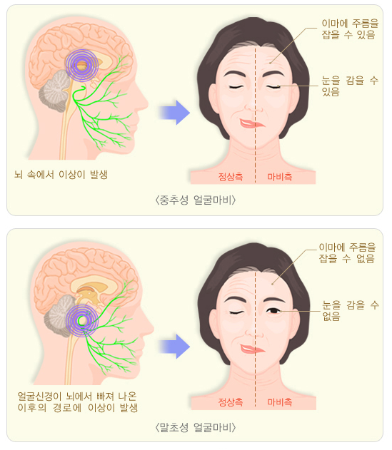 일등한의원 이미지