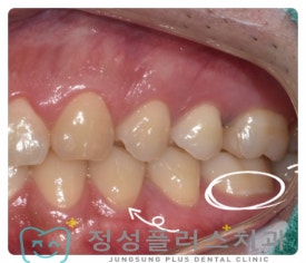 정성플러스치과 이미지