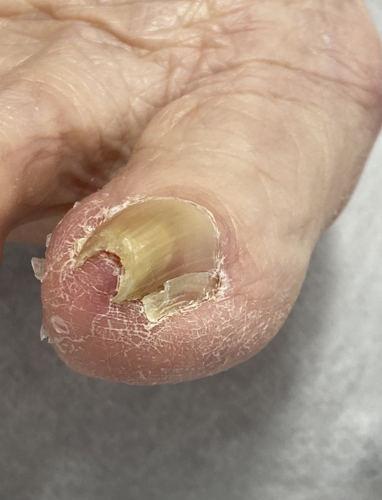 부천디에고푸스본점어딕션네일&풋케어전문 이미지