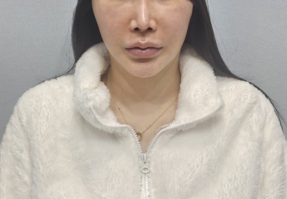 젤성형외과의원 이미지