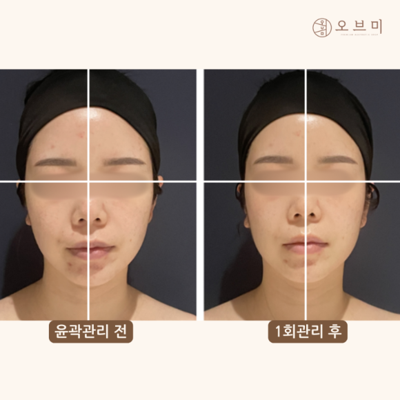 오브마곡 이미지