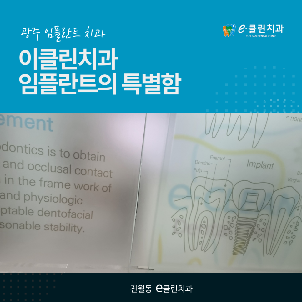 이제이클린 이미지