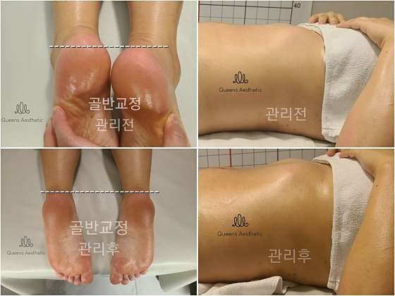 퀸즈산모케어 이미지