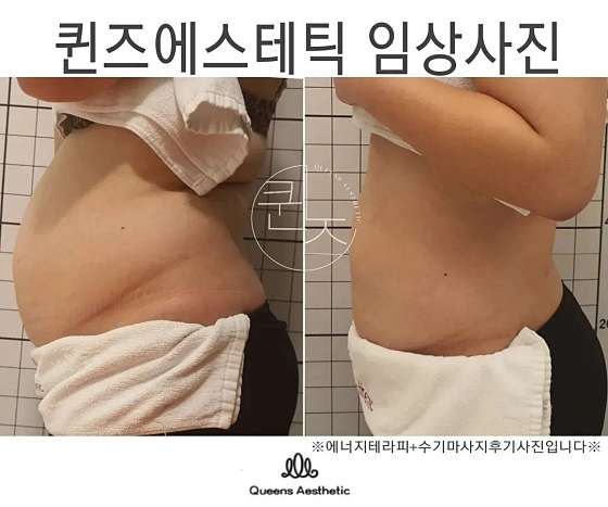 퀸즈산모케어 이미지