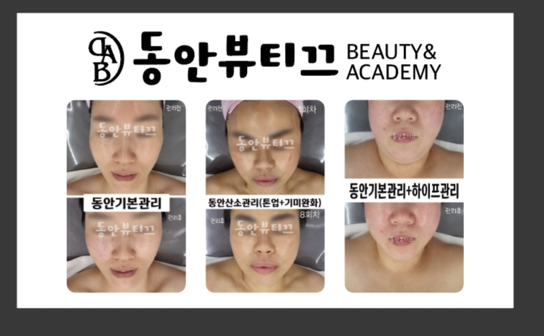 동안뷰티끄 이미지