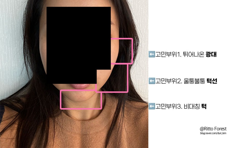아바에스테틱 이미지