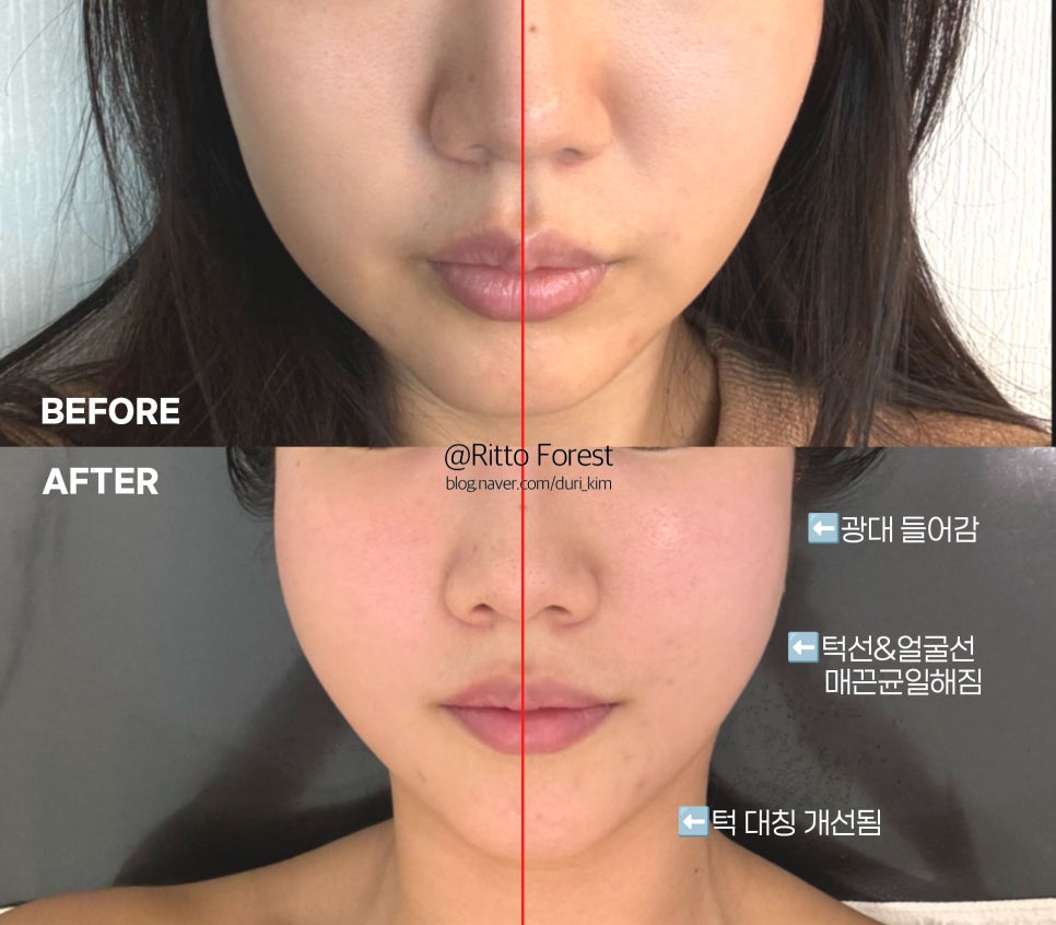 아바에스테틱 이미지