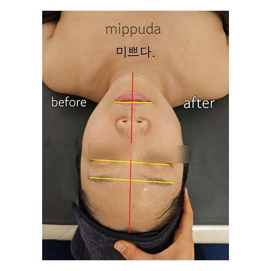미쁘다피부관리 이미지