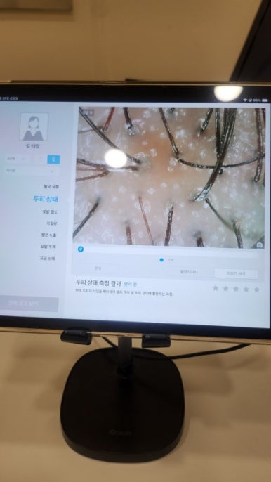 탈모케어존부산 이미지