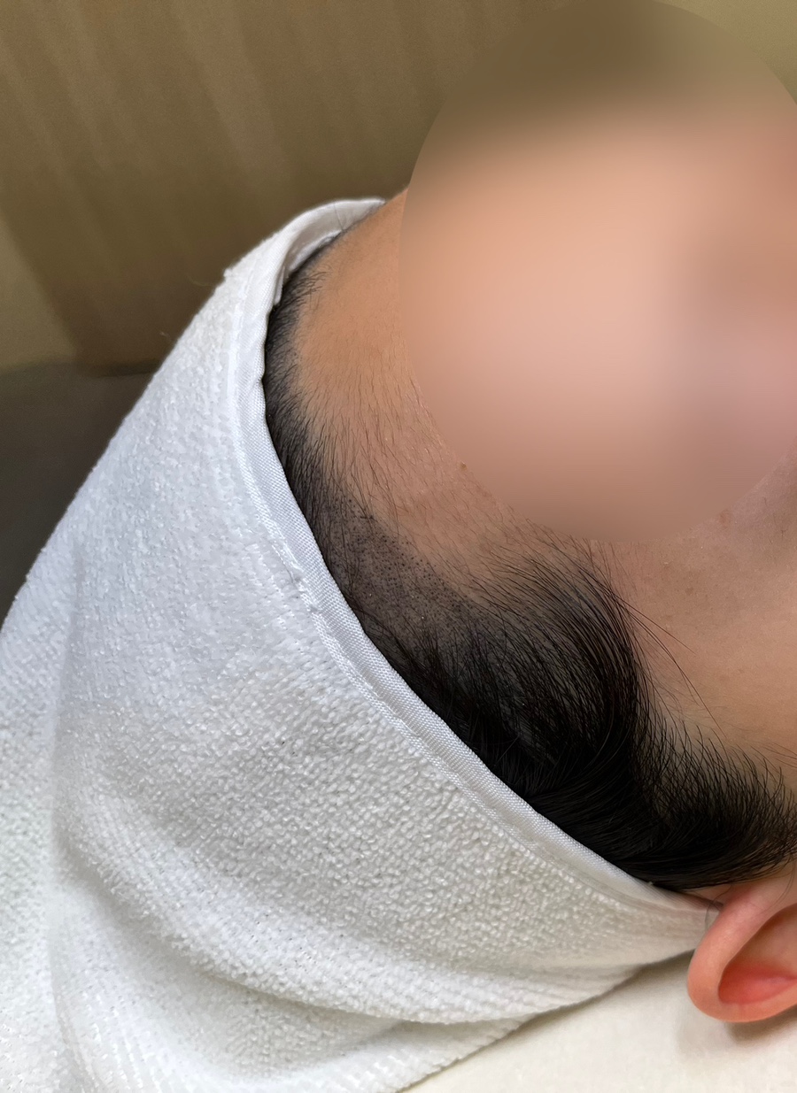 퀸헤어라인 이미지