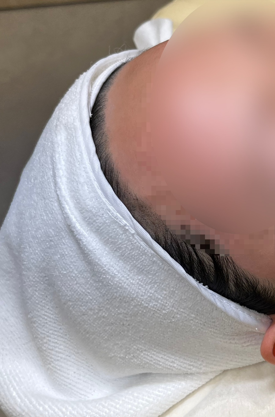 퀸헤어라인 이미지