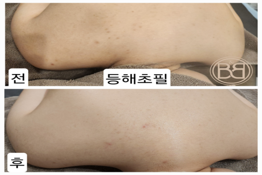 비앤비 에스테틱 이미지