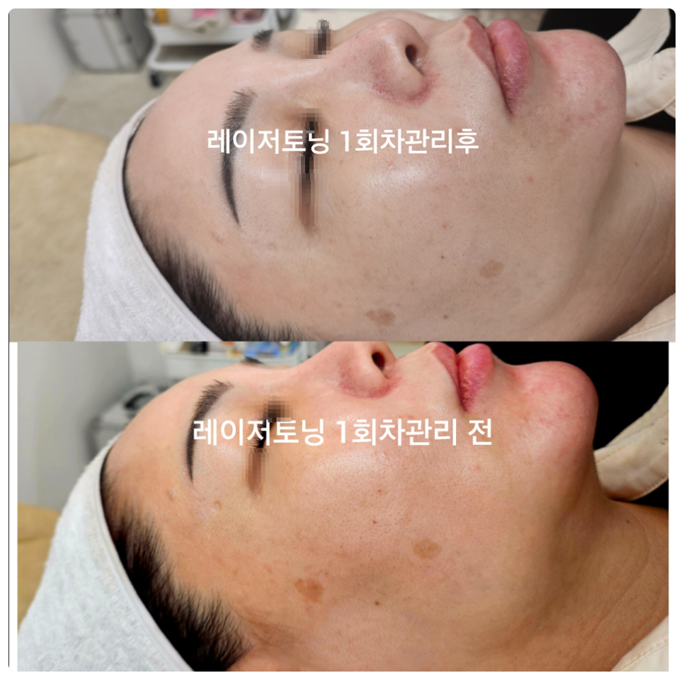 청담윤뷰티 이미지