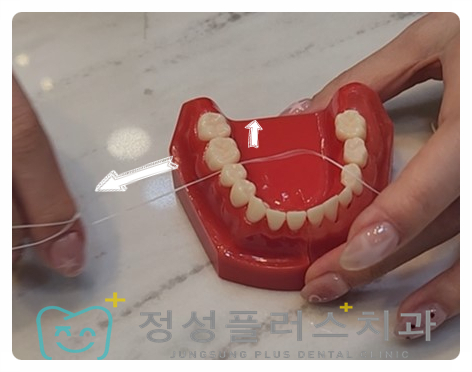 정성플러스치과 이미지
