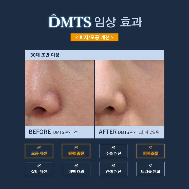 피부,맑음 이미지