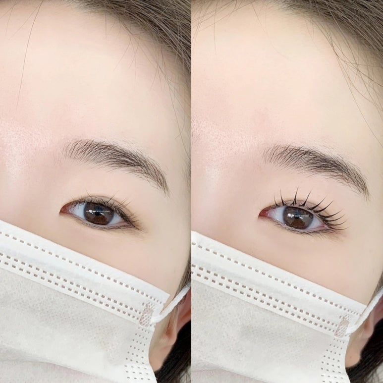 루채뷰티 이미지