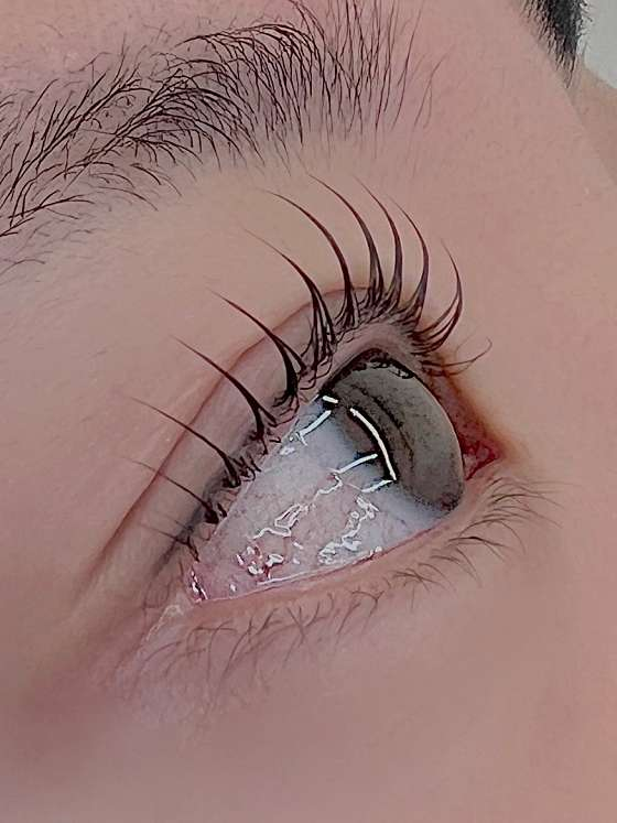 아이섭 이미지