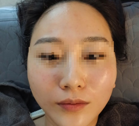 에스테틱베이비페이스 이미지