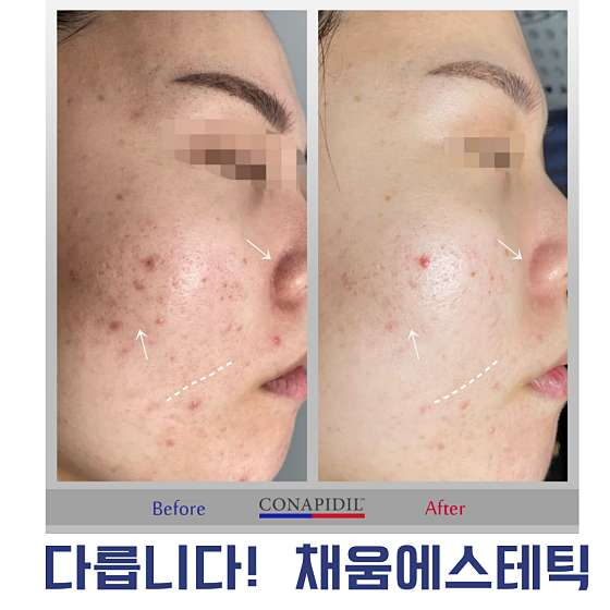 채움에스테틱 이미지
