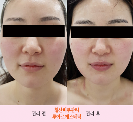 피부관리 이미지