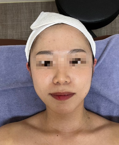 레드문글로벌 이미지