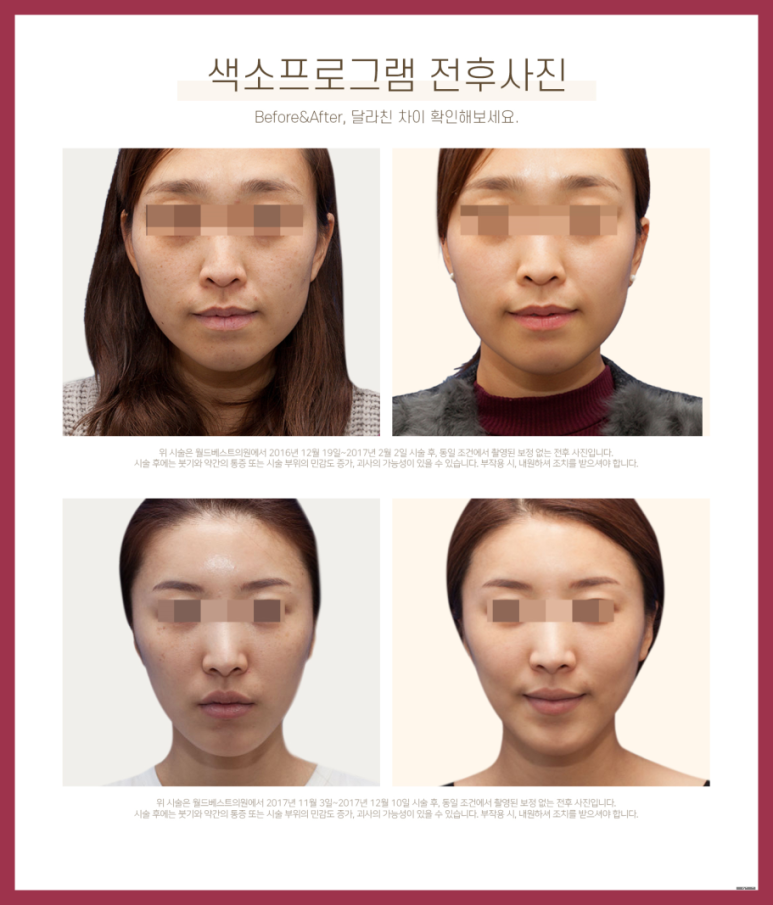 착한피부과 이미지