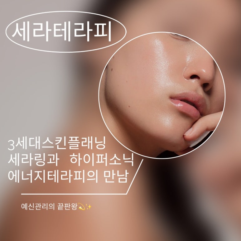 세라에너지 이미지