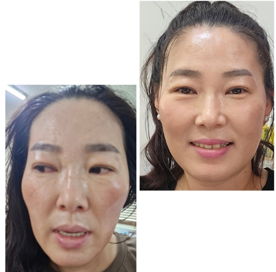 닥터시스 셀클럽 이미지