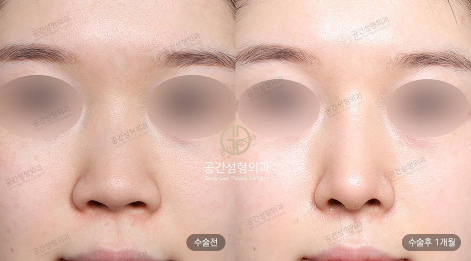 케이스코 이미지