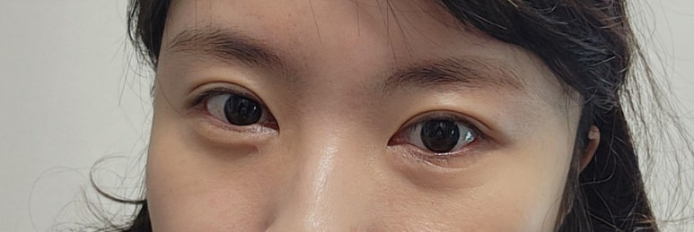 아이 엠(eye m) 이미지
