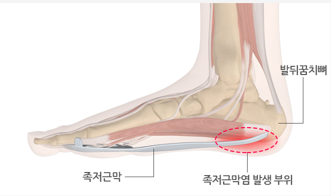 월배역바로정형외과 이미지
