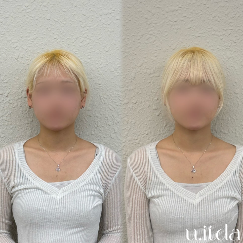 유잇다붙임머리 이미지