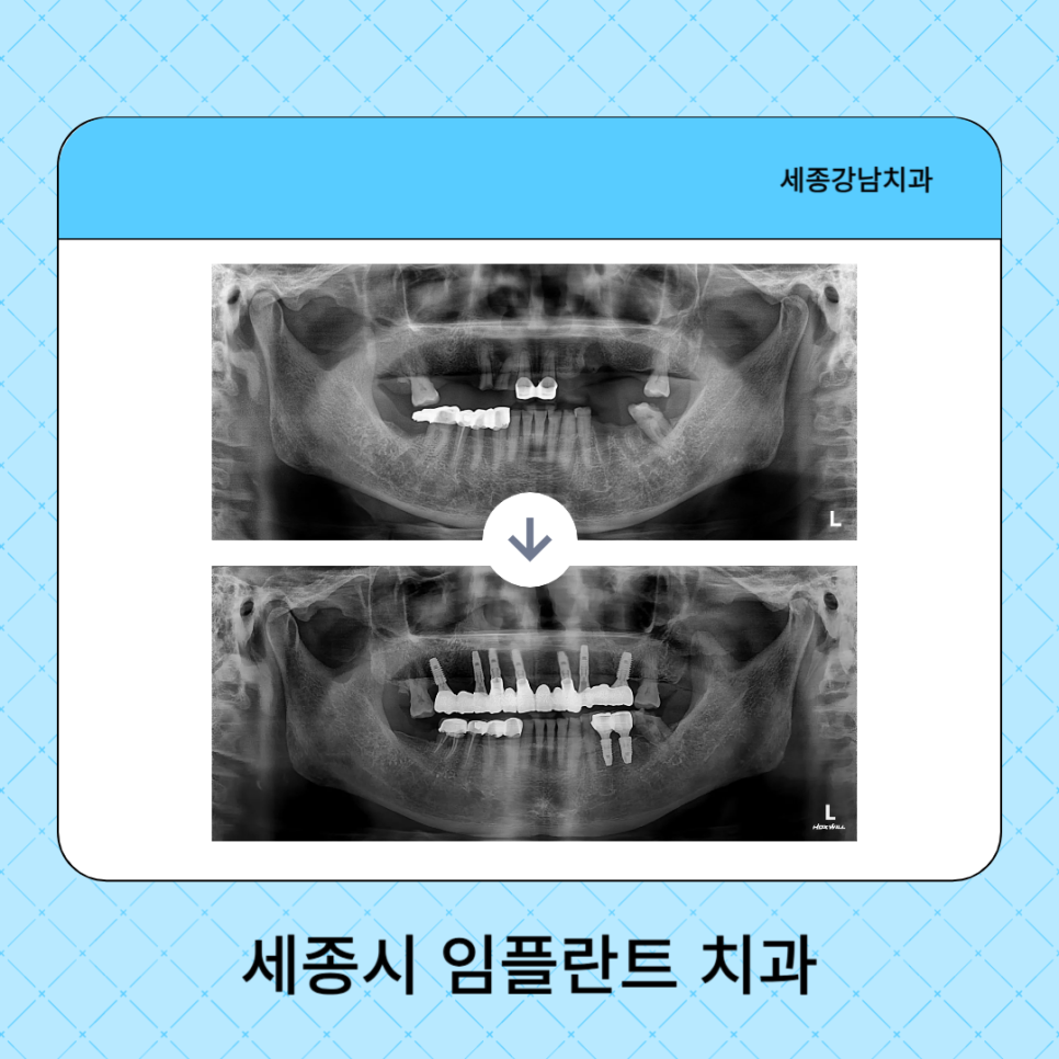 강남세종치과의원 이미지
