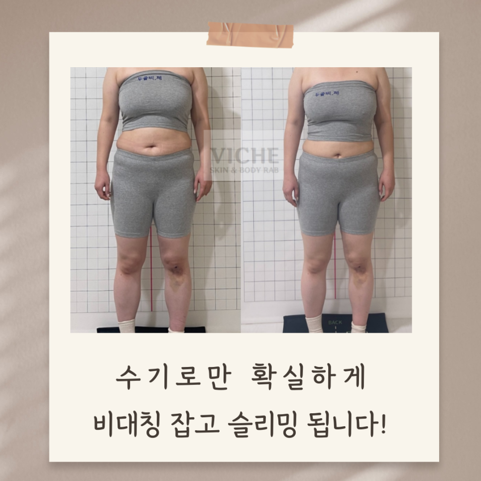 미미체형관리 이미지