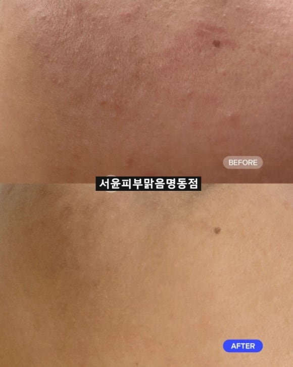 맑음조각 이미지