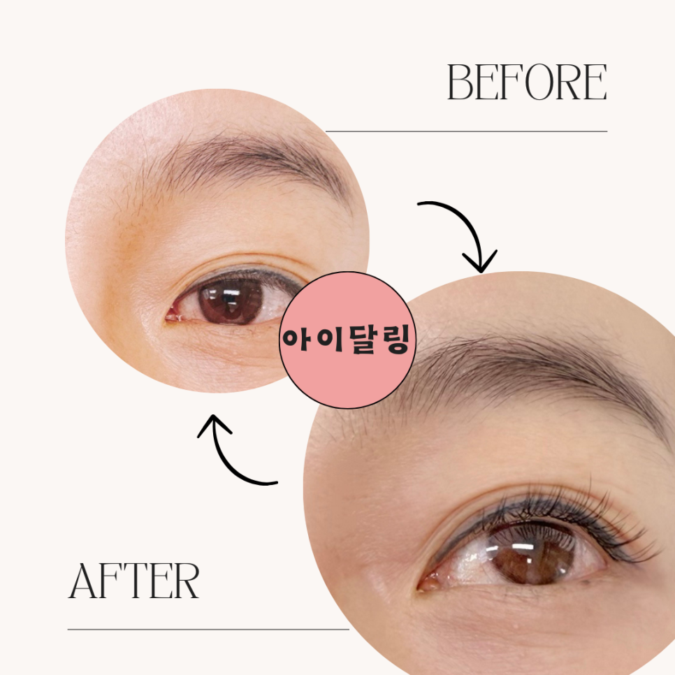 아이달링(EYE달링) 이미지