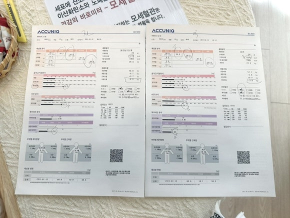 링 에스테틱 이미지