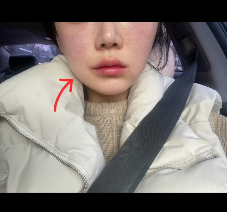 서울뉴라인의원 이미지