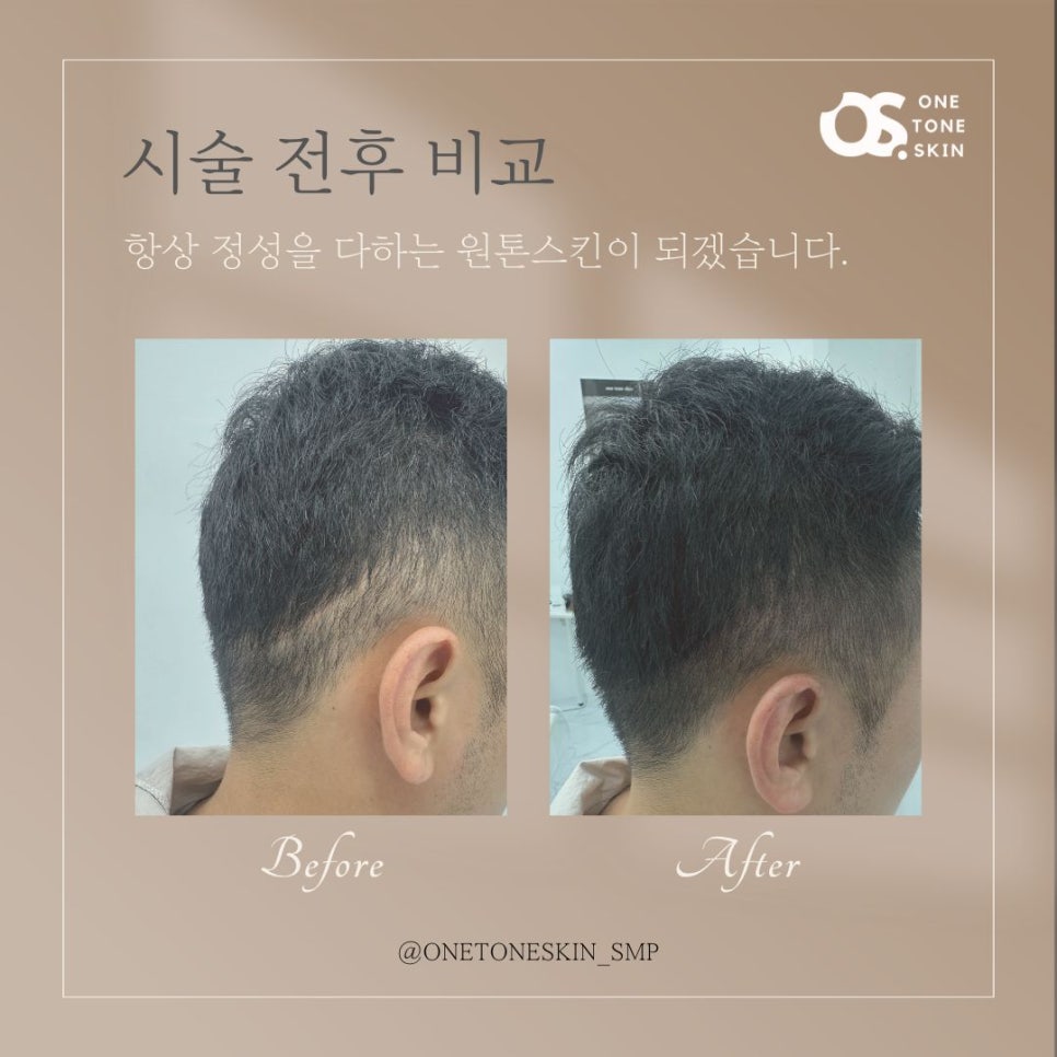 원톤스킨 이미지