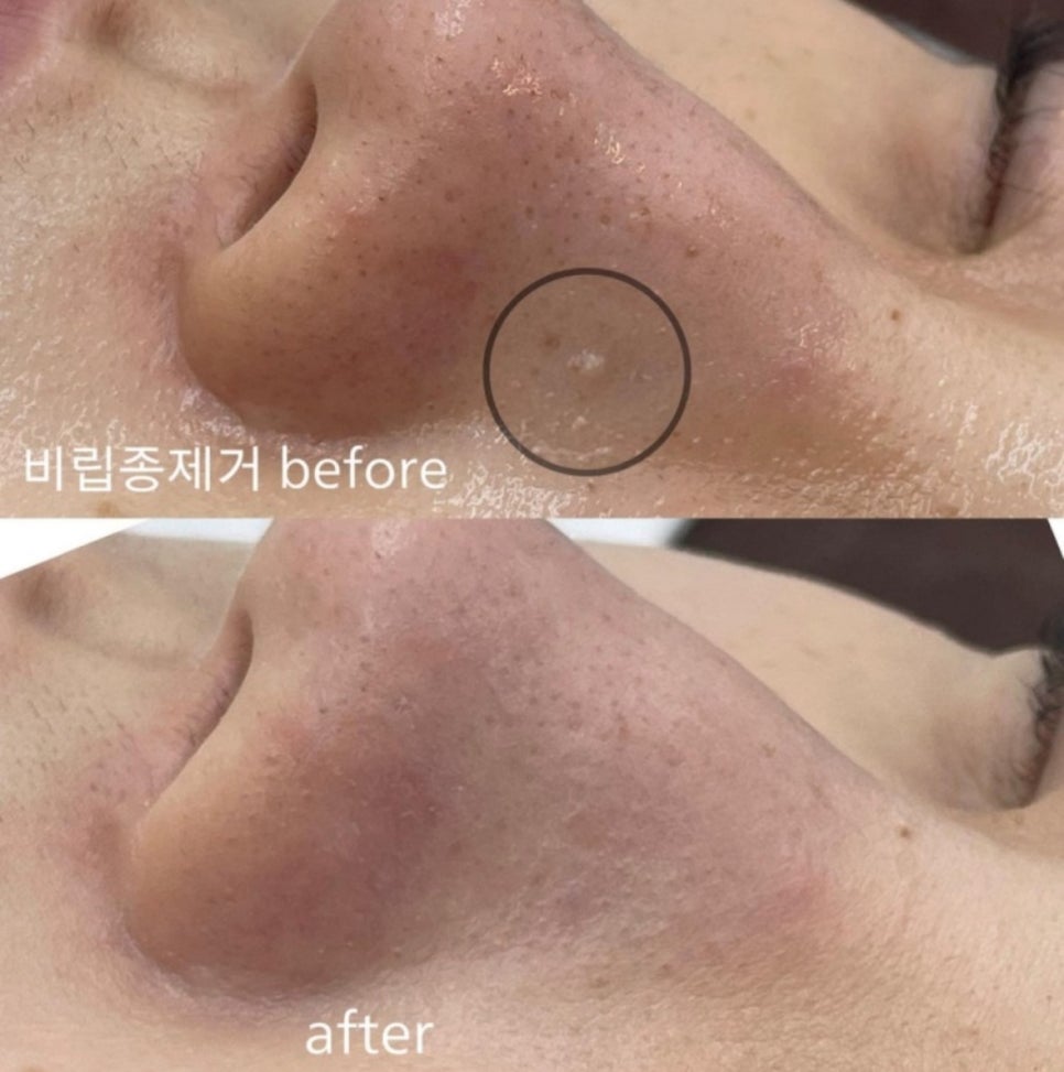 오르뷰티 이미지