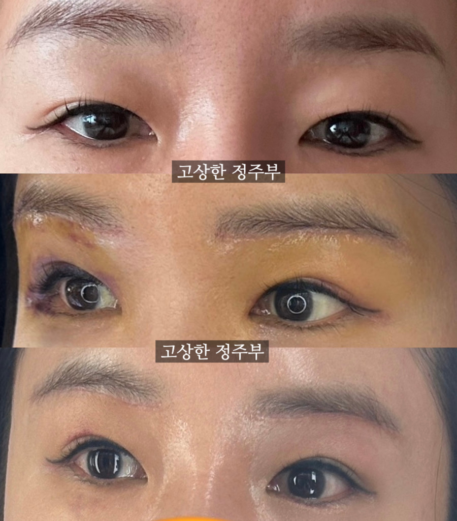 뽑아쥬 이미지